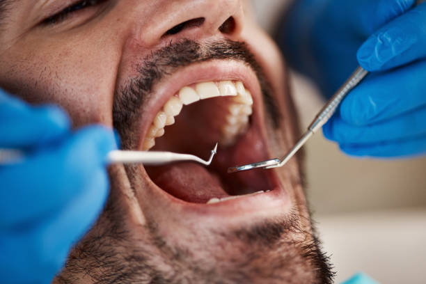 Best Broken or Chipped Tooth Repair in Firebaugh, CA